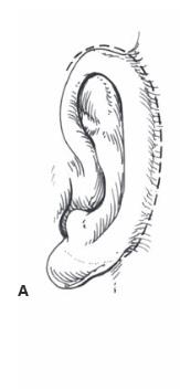 Elevation of framework 1