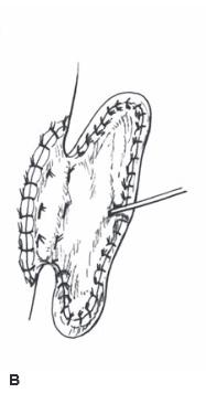 Elevation of framework B