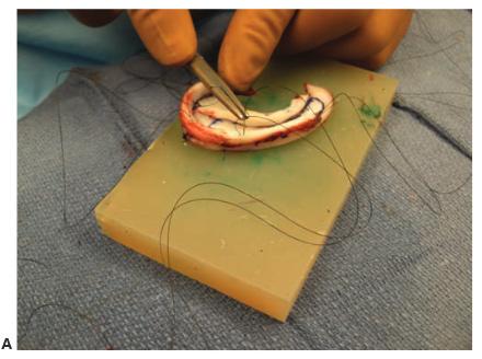 Construction of the cartilage A