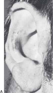 Congenital Anomalies1