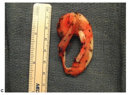 Construction of the cartilage C