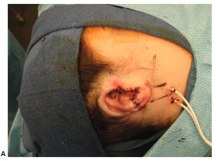 Appearance of the framework A