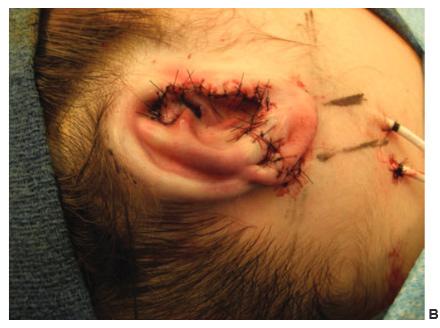 Appearance of the framework B