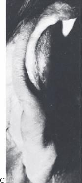 Congenital Anomalies 3