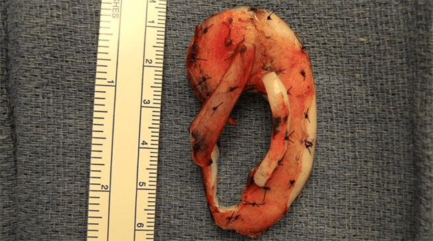 undersurface of framework